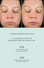 Load image into Gallery viewer, I-WAKEN RESURFACING MASK
