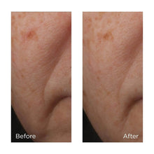 Load image into Gallery viewer, Cold Plasma+Advanced Serum Concentrate 1 oz