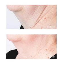 Load image into Gallery viewer, Cold Plasma+ Sub D Neck Cream 2 oz