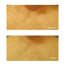 Load image into Gallery viewer, Neuropeptide Restorative Neck & Chest Therapy SPF 25 2 oz