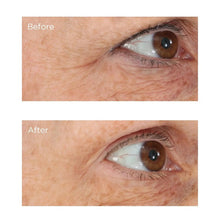 Load image into Gallery viewer, Essential Fx Eye Lift Serum 0.5 oz