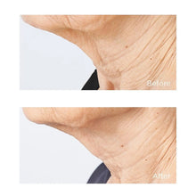 Load image into Gallery viewer, Cold Plasma+ Sub D Neck Cream 2 oz