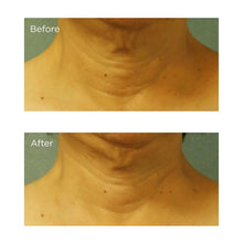 Load image into Gallery viewer, Cold Plasma+ Neck & Chest SPF 25 1 oz