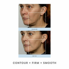 Load image into Gallery viewer, Trinity PRO Facial Toning Kit
