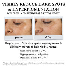 Load image into Gallery viewer, Cc Dark Spot 100Ml

