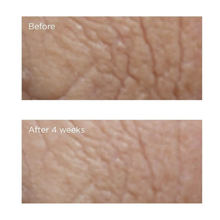 Load image into Gallery viewer, Neuropeptide Facial Conformer (Large) 2 oz
