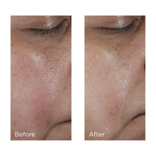 Load image into Gallery viewer, Intensive Pore Minimizing Toner  4 oz
