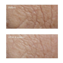 Load image into Gallery viewer, Neuropeptide Smoothing Facial Conformer 1 oz
