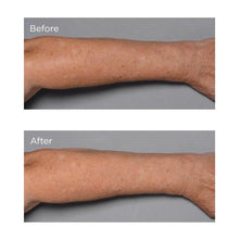 Load image into Gallery viewer, Cold Plasma+ Fragile Skin Therapy 6 oz
