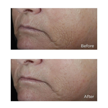 Load image into Gallery viewer, Neuropeptide Facial Conformer (Large) 2 oz
