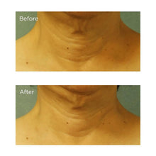 Load image into Gallery viewer, Cold Plasma+ Neck &amp; Chest SPF 25  1 oz
